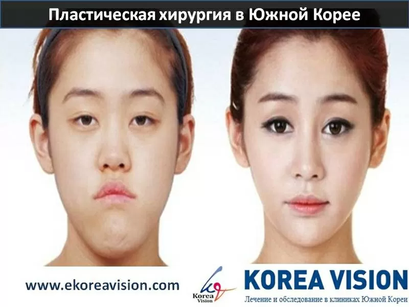 Пластическая хирургия в Южной Корее Компания 
